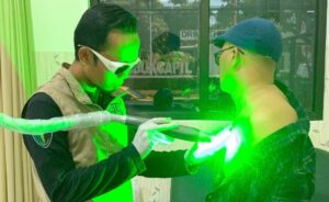 Polresta Banyuwangi Gelar Bakti Kesehatan Hapus Tato, 28 Peserta Ikuti Proses Penghapusan dengan Laser