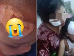 PLN UP3 Banyuwangi Dinilai Abai Tanggapi Insiden Kabel Putus yang Lukai Satu Keluarga